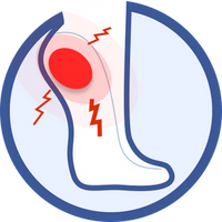 Plantar Fasciitis